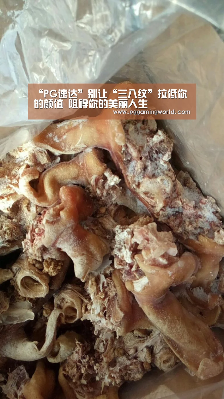 “PG速达”别让“三八纹”拉低你的颜值 阻碍你的美丽人生(图1) PG娱乐