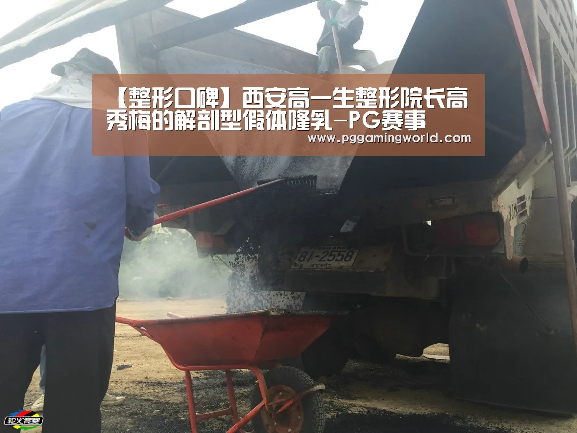 【整形口碑】西安高一生整形院长高秀梅的解剖型假体隆乳-PG赛事(图1) PG赛事